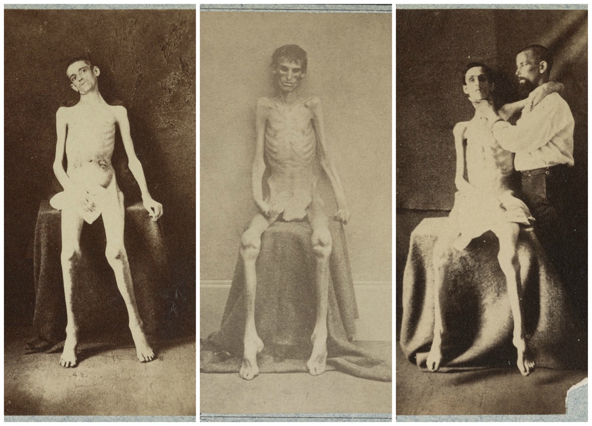 b34d02f059cb6a52a344b9491fc32ff7a1096edf